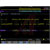 Tektronix - DPO4BND - 4000B Series Bundled Application Software Oscilloscope Accessories|70462136 | ChuangWei Electronics